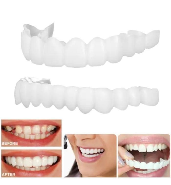 FIT FLEX ADJUSTABLE TEETH COVER (🔥Buy 1 Get 1 Free🔥)