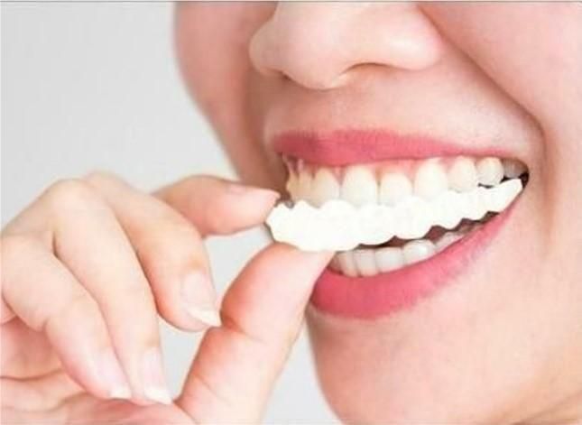 FIT FLEX ADJUSTABLE TEETH COVER (🔥Buy 1 Get 1 Free🔥)
