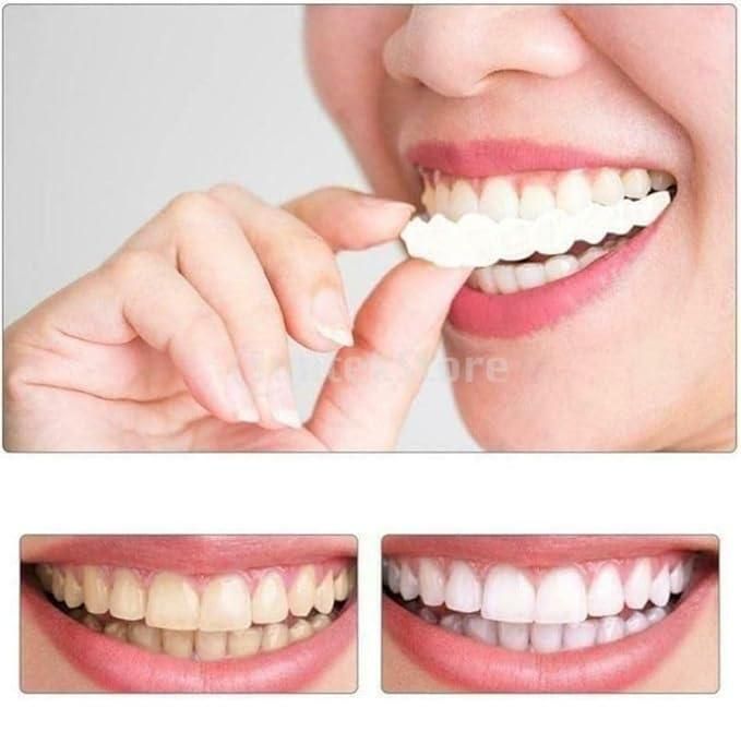 FIT FLEX ADJUSTABLE TEETH COVER (🔥Buy 1 Get 1 Free🔥)