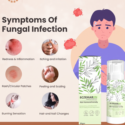 Herbal Psoriasis Eczema Relief Spray  (🔥Buy 1 Get 1 Free🔥)(Pack Of 2)