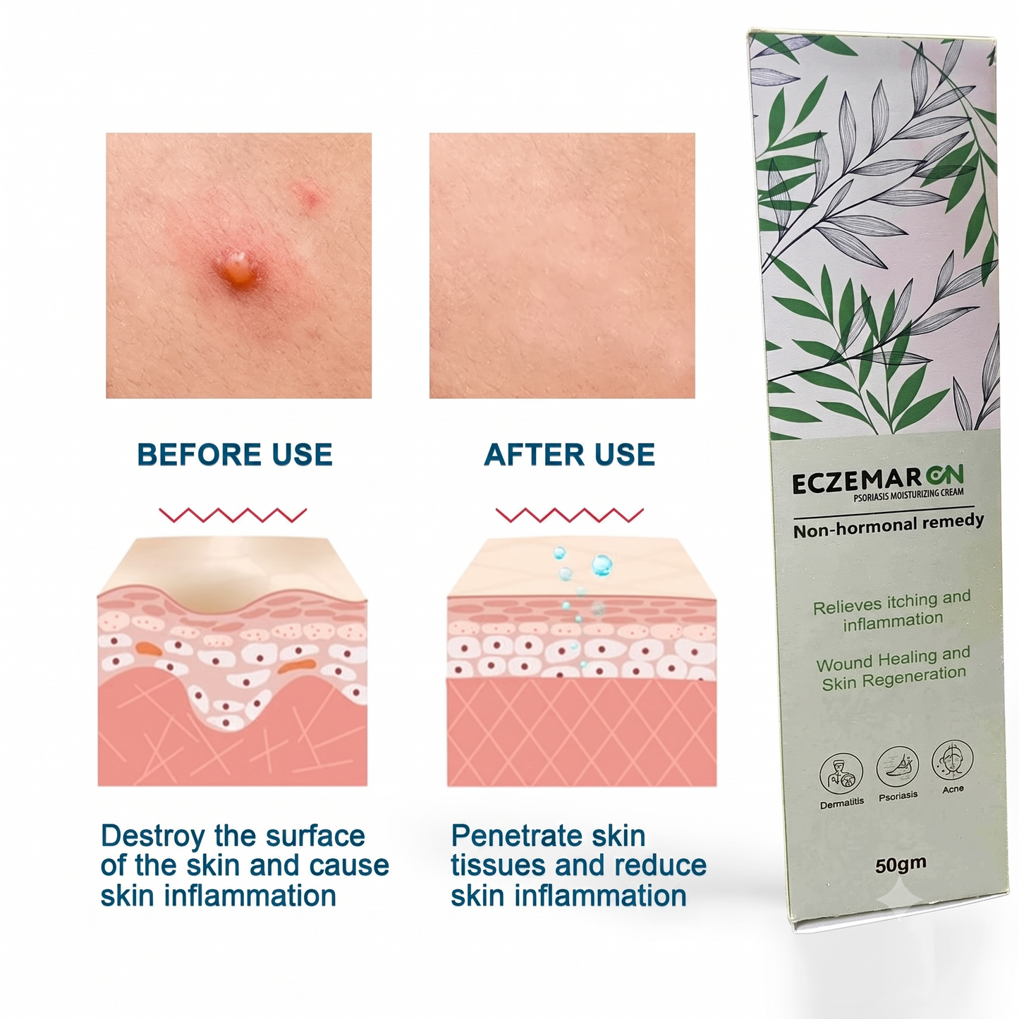 Herbal Psoriasis Eczema Relief Spray  (🔥Buy 1 Get 1 Free🔥)(Pack Of 2)