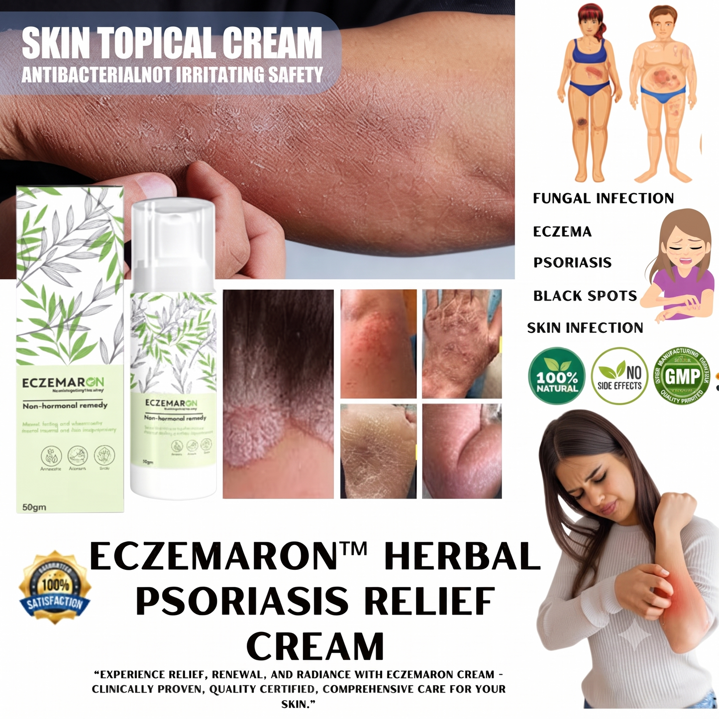Herbal Psoriasis Eczema Relief Spray  (🔥Buy 1 Get 1 Free🔥)(Pack Of 2)