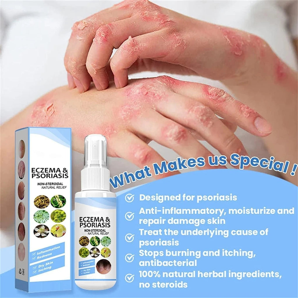 Herbal Psoriasis Eczema Relief Spray (Pack Of 2)