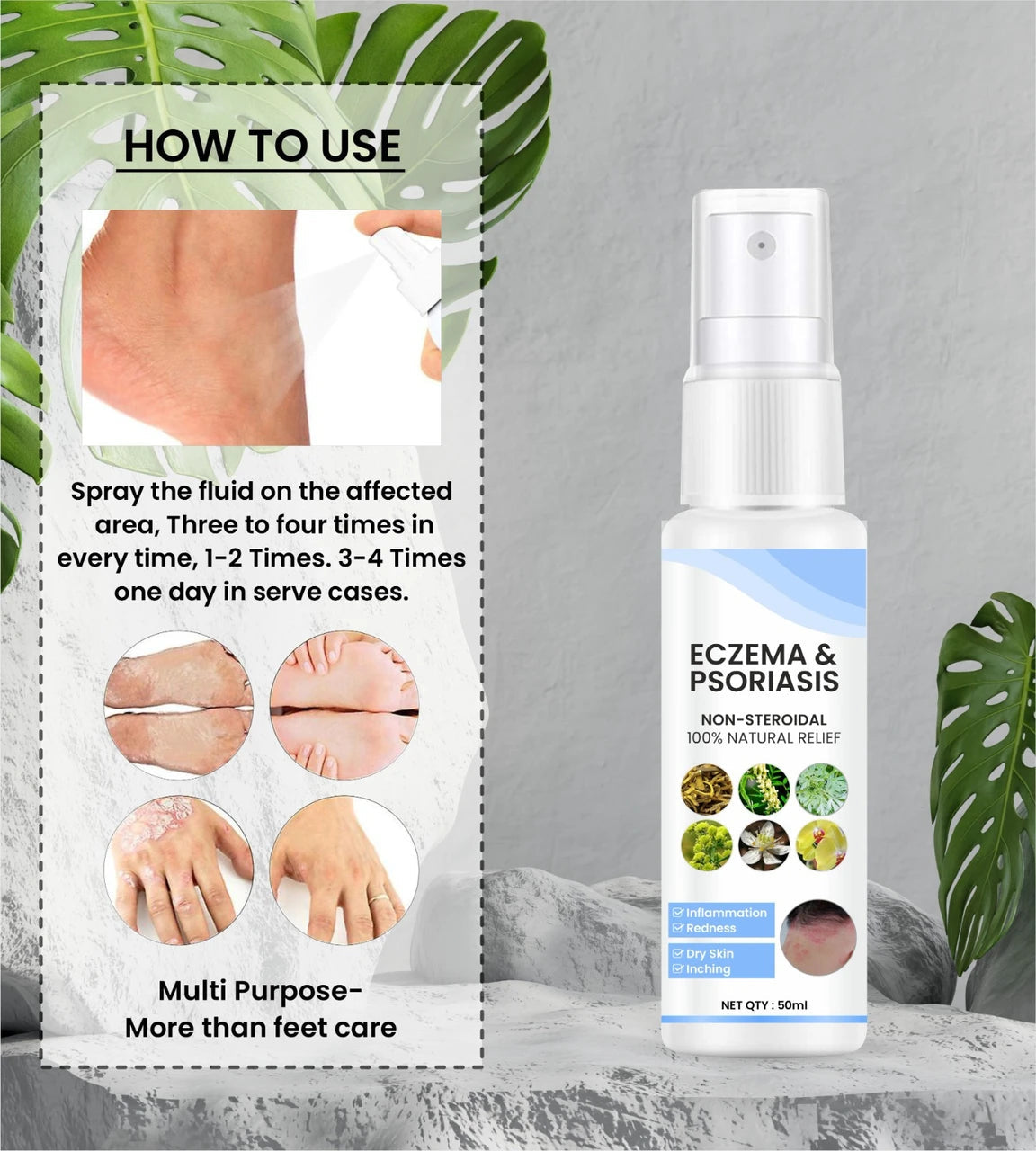 Herbal Psoriasis Eczema Relief Spray (Pack Of 2)